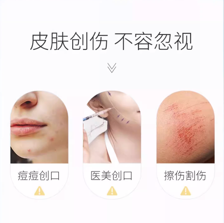 Voolga Recombinant Type III Collagen Dressing