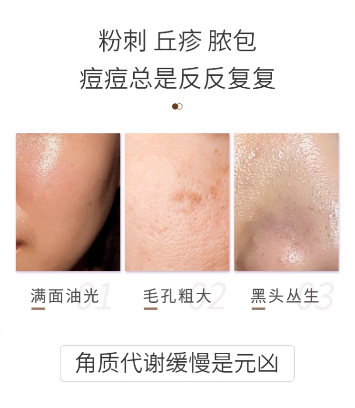 Voolga Lactic Acid Oil Control and Astringent Mask