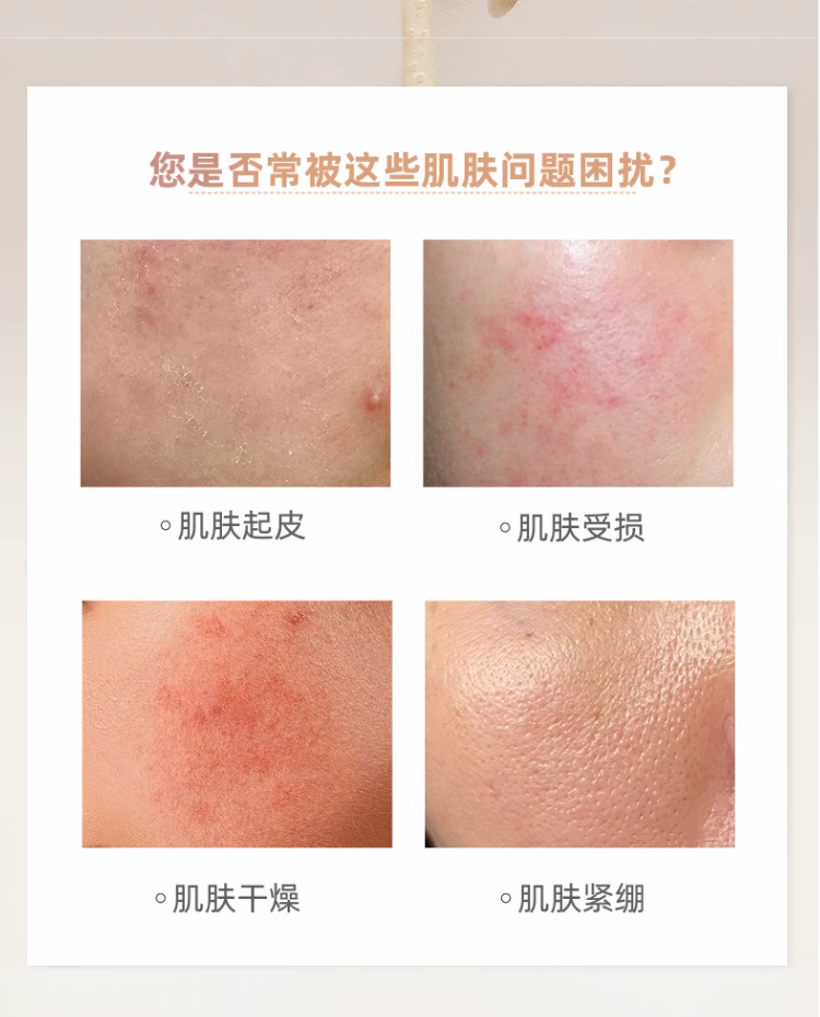敷尔佳沙漠植物保湿修护贴