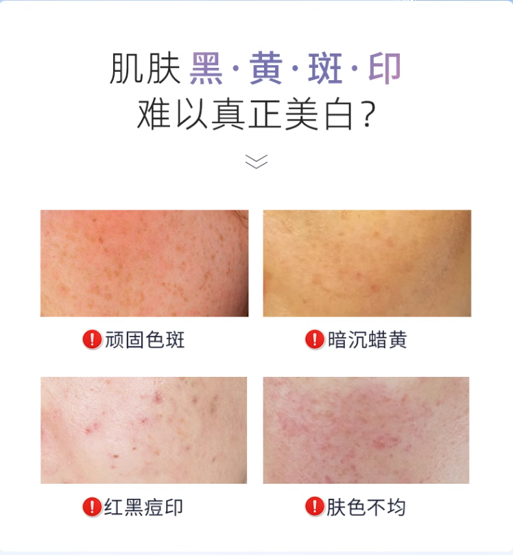 焕采亮白滋润套装